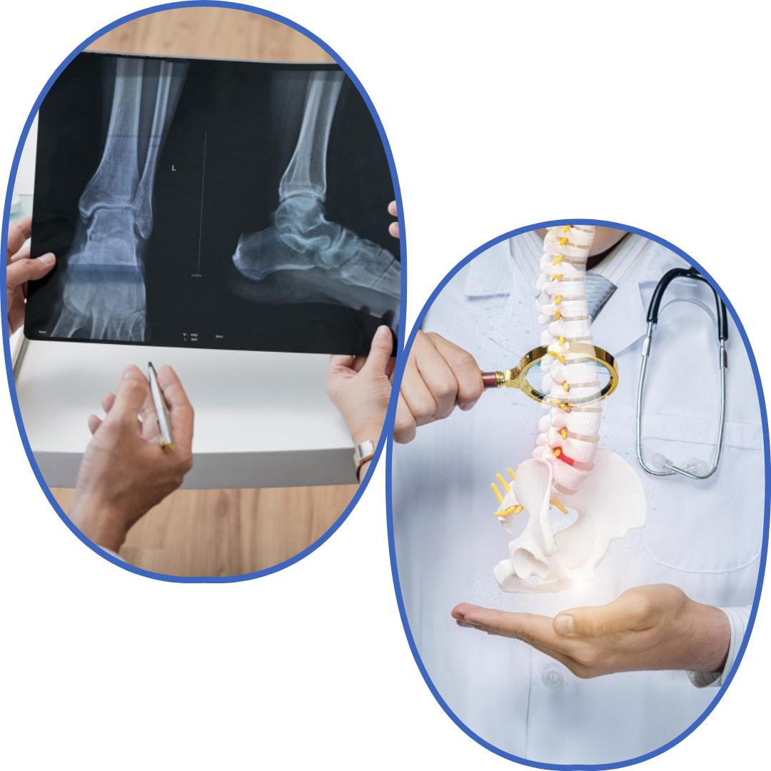 Diagnóstico y tratamiento de ciática en Cuautitlán Izcalli